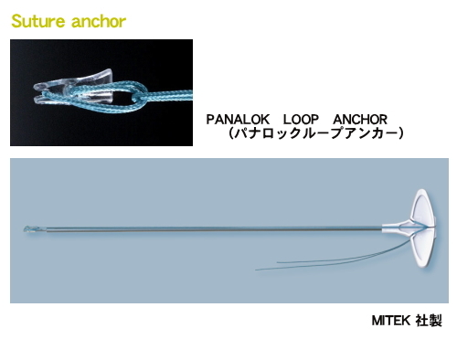 Suture anchor