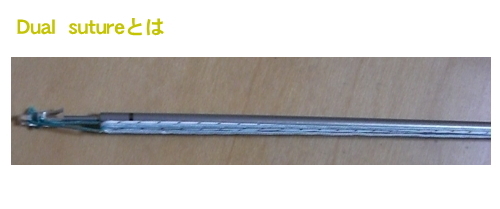 Dual suture