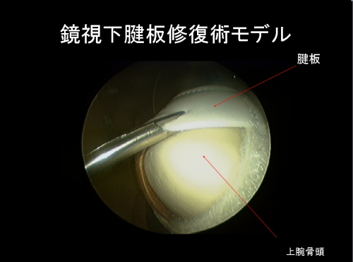 鏡視下腱板修復術モデル