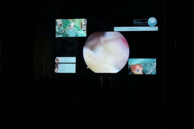 私の口演のシーン