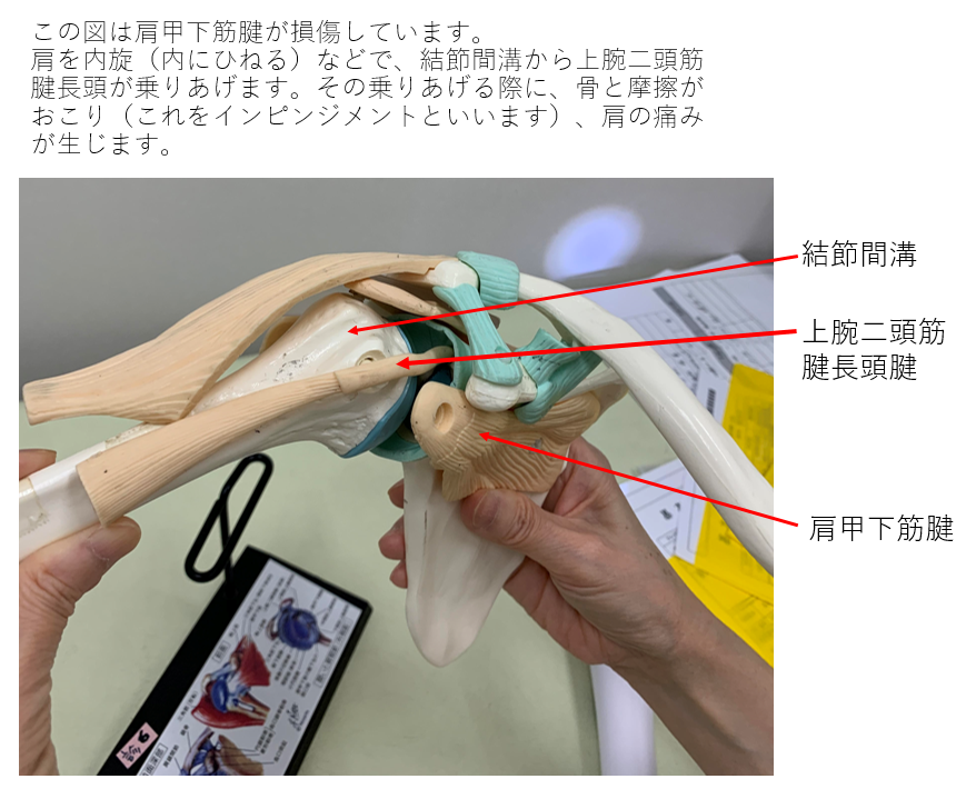 上腕二頭筋腱損傷のおこる仕組み