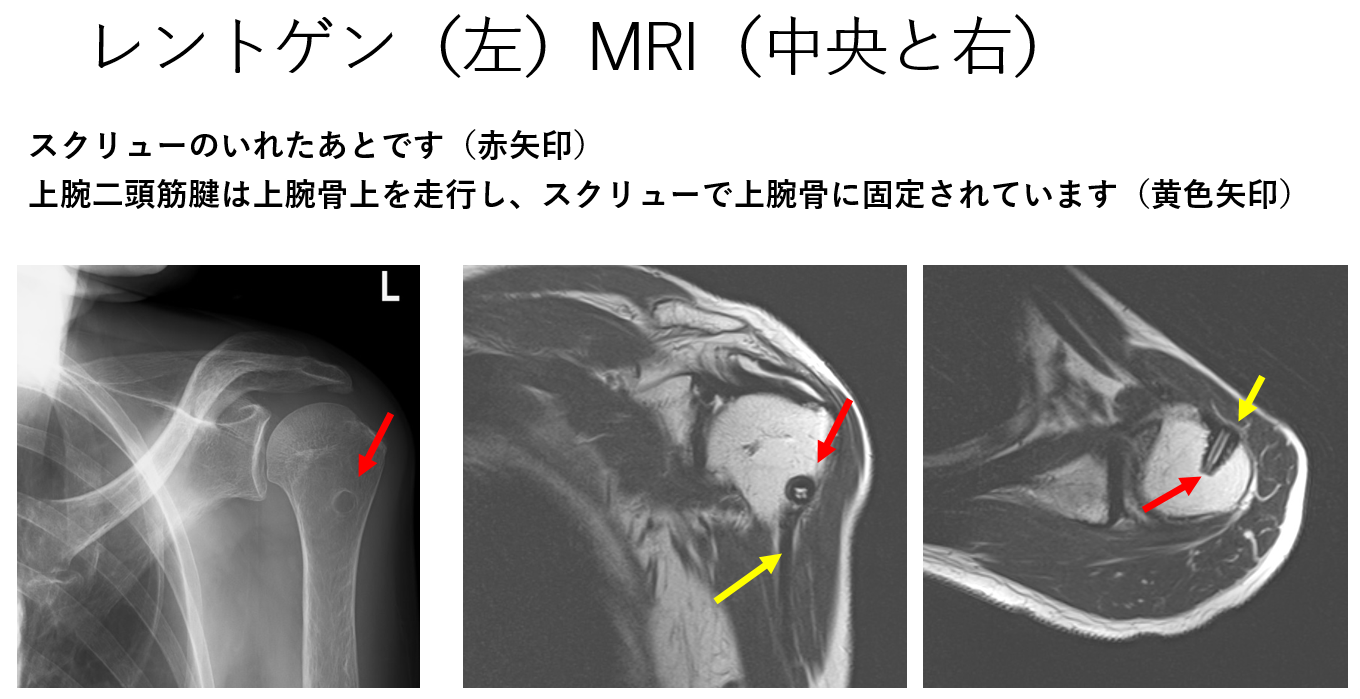 レントゲンやMRI