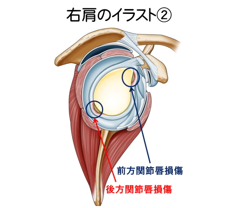 右肩のイラスト2