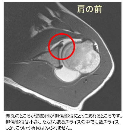 造影MRI
