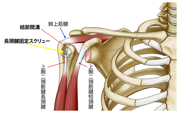 手術