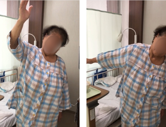 手術前の動き