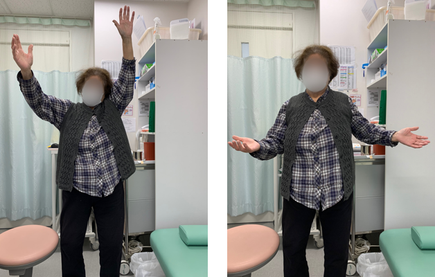 手術3年