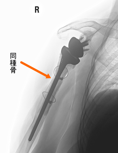 手術3年
