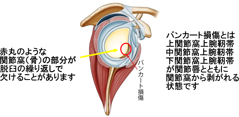 右肩のイラスト