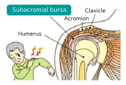 Subacromial bursa