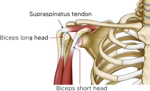 Biceps tendon injury