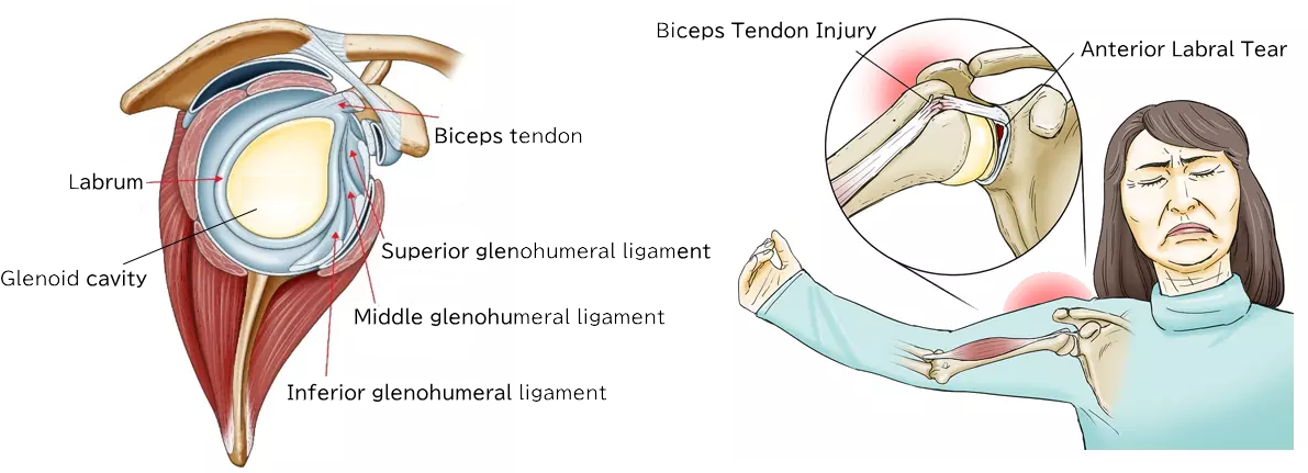 Condition of the Shoulder