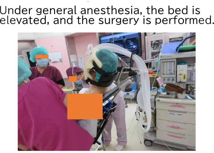 Under general anesthesia, the bed is  elevated, and the surgery is performed.