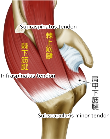 This illustration shows the right shoulder, where the supraspinatus muscle and infraspinatus muscle extend from the scapula and attach to the humerus.