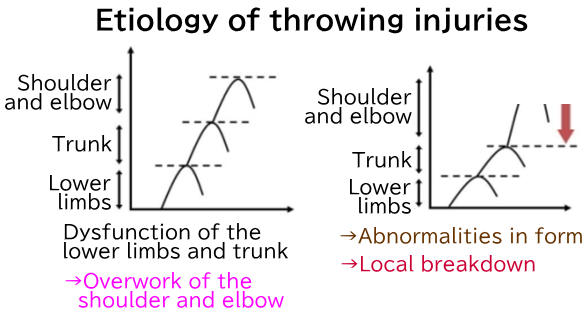 Etiology of throwing injuries
