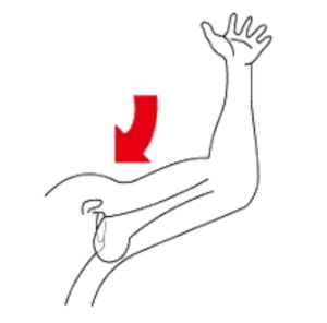 Shoulder dislocation