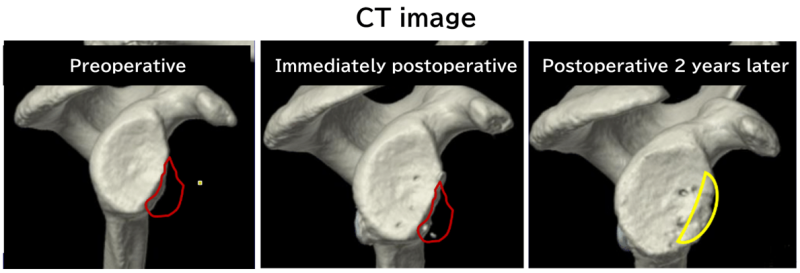 ct-image
