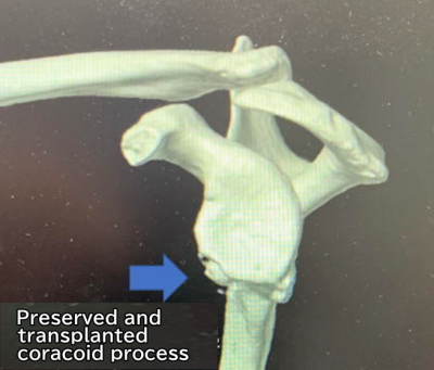 CT images 3
