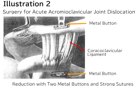 Illustration 2